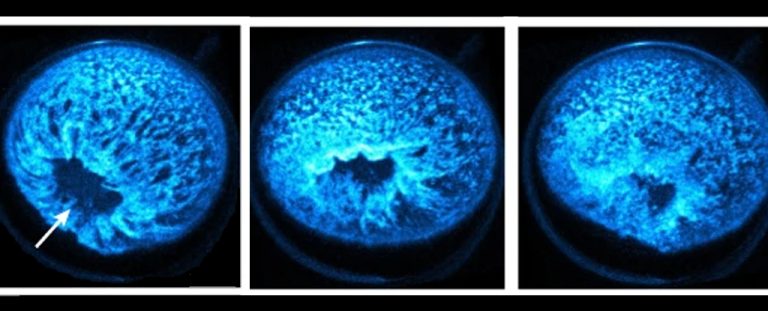 Changingshapeofthemyoplasmmoleculeshighlightedinblue.jpg