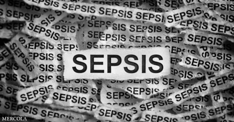 Sepsis Death Rate Fb.jpg