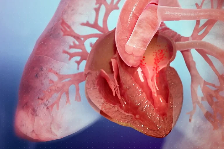 1800x1200 Medical Animation Inside Looks At Heart Failure Video.jpg