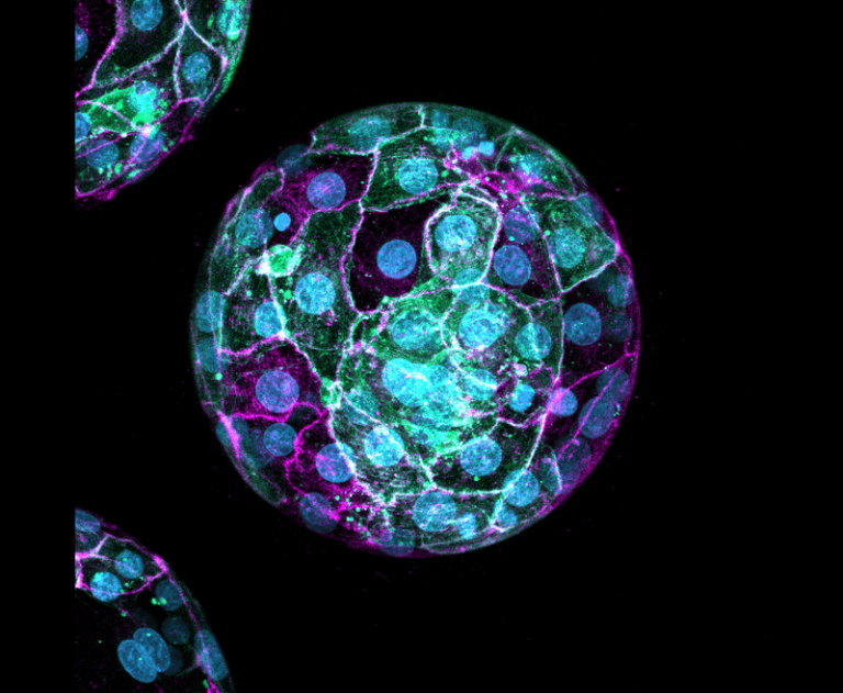 Embryo 3 Magenta Green M.png