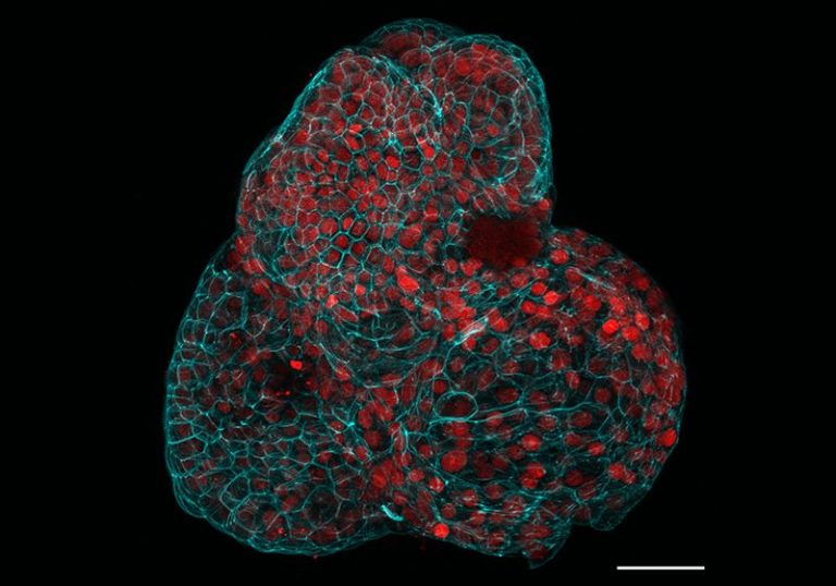 Lung Organoid 800x560 M.jpg