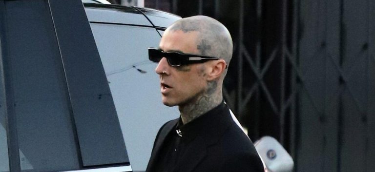 Travis Barker Finger Surgery E1677559140120.jpg